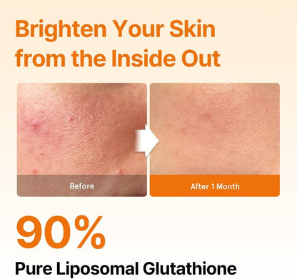 Liposomal Glutathione Oral Strips – Antioxidant Skin Support